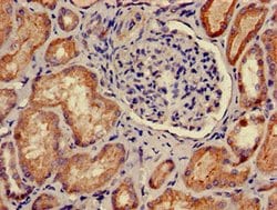 Invitrogen PKA beta Polyclonal Antibody 100 μg; Unconjugated:Antibodies,