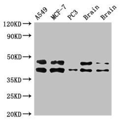 Invitrogen PKA beta Polyclonal Antibody 100 μg; Unconjugated:Antibodies,