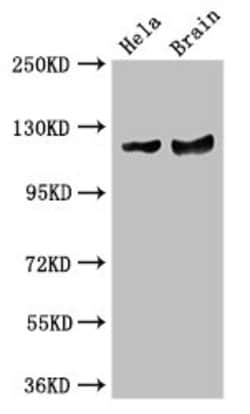 Invitrogen RASA1 Polyclonal Antibody 100 &mu;g | Buy Online | Invitrogen&trade; | Fisher Scientific