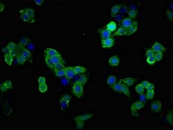 Invitrogen GLT-1 Polyclonal Antibody 100 &mu;g; Unconjugated:Antibodies,