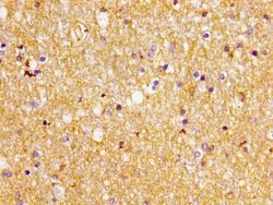 Invitrogen GLT-1 Polyclonal Antibody 100 &mu;g; Unconjugated:Antibodies,