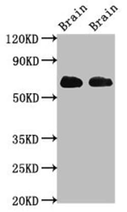 Invitrogen GLT-1 Polyclonal Antibody 100 &mu;g; Unconjugated:Antibodies,