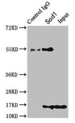 Invitrogen SOD1 Polyclonal Antibody 100 &mu;g; Unconjugated:Antibodies,