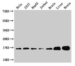 Invitrogen SOD1 Polyclonal Antibody 100 &mu;g; Unconjugated:Antibodies,