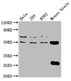 Invitrogen TUBB4A Polyclonal Antibody 100 &mu;g | Buy Online | Invitrogen&trade; | Fisher Scientific