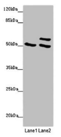 Invitrogen TUBB4A Polyclonal Antibody 100 &mu;g | Buy Online | Invitrogen&trade; | Fisher Scientific