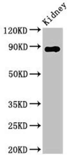 Invitrogen CD26 Polyclonal Antibody 100 &mu;g | Buy Online | Invitrogen&trade; | Fisher Scientific