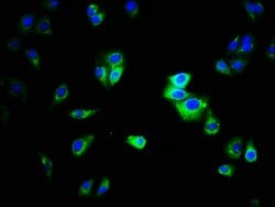 Invitrogen CEACAM1 Polyclonal Antibody 100 &mu;g; Unconjugated:Antibodies,