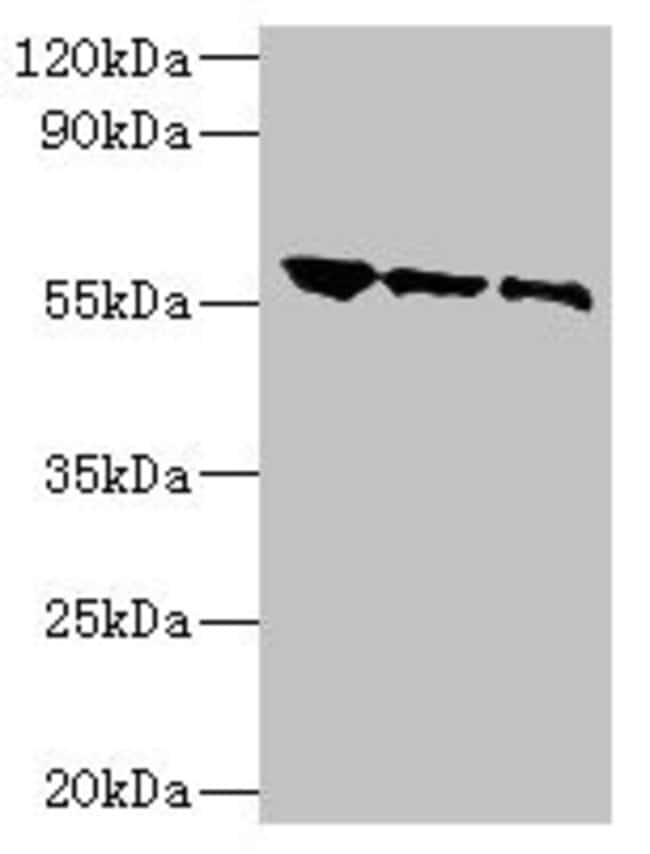 Rabies Virus Glycoprotein Polyclonal Antibody, Invitrogen 100 μg