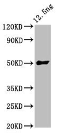 Invitrogen Soybean FTL3 Polyclonal Antibody 100 &mu;g; Unconjugated:Antibodies,