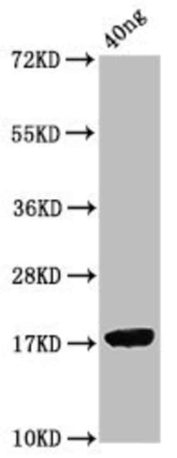 PRRS Virus ORF7 Polyclonal Antibody:Antibodies, Polyclonal