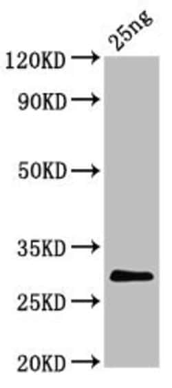 Invitrogen Bovine Coronavirus Spike Protein Polyclonal Antibody 100 &mu;L;