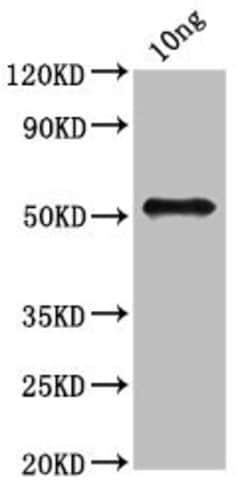 Invitrogen Mycobacterium kansasii Ag85B Polyclonal Antibody 100 &mu;L | Buy Online | Invitrogen&trade; | Fisher Scientific