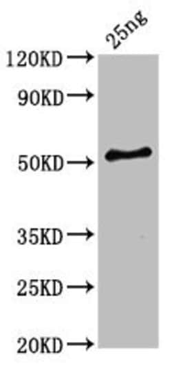 Invitrogen Clostridium botulinum HA-33 Polyclonal Antibody 100 &mu;L; Unconjugated:Antibodies,