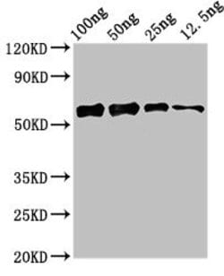 Invitrogen Staphylococcus aureus ALD1 Polyclonal Antibody 100 &mu;g; Unconjugated:Antibodies,