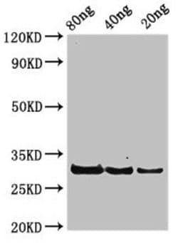 Invitrogen Staphylococcus aureus rplL Polyclonal Antibody 100 &mu;g | Buy Online | Invitrogen&trade; | Fisher Scientific