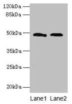 Invitrogen E. coli SurA Polyclonal Antibody 100 &mu;g; Unconjugated:Anticuerpos