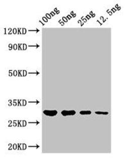 Invitrogen Salmonella typhi hupB Polyclonal Antibody 100 &mu;g; Unconjugated:Antibodies,