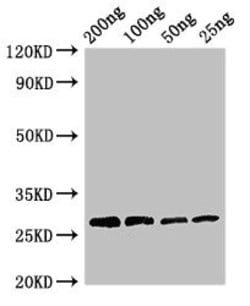 Papain Polyclonal Antibody:Antibodies, Polyclonal