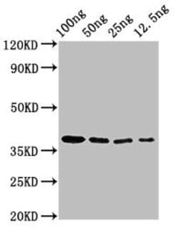 Invitrogen Epstein Barr Virus BZLF2 Polyclonal Antibody 100 &mu;g; Unconjugated:Antibodies,