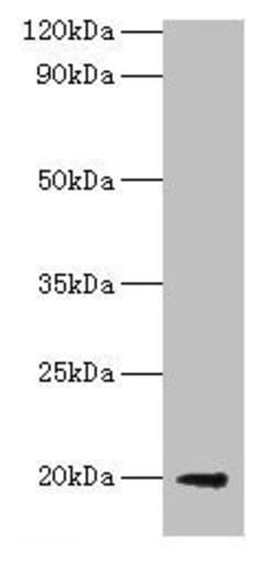 Invitrogen E. coli luxS Polyclonal Antibody 100 &mu;g; Unconjugated:Antibodies