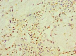 Invitrogen STARD3 Polyclonal Antibody 100 &mu;L | Buy Online | Invitrogen&trade; | Fisher Scientific