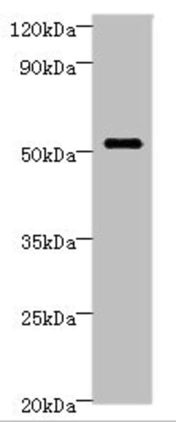 Invitrogen STARD3 Polyclonal Antibody 100 &mu;L | Buy Online | Invitrogen&trade; | Fisher Scientific