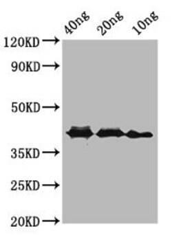 Invitrogen&trade;&nbsp;Rickettsia conorii ompA Polyclonal Antibody