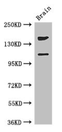 Invitrogen PREX2 Polyclonal Antibody 100 &mu;g; Unconjugated:Antibodies,