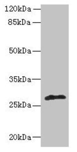 Invitrogen FABI Polyclonal Antibody 100 &mu;g | Buy Online | Invitrogen&trade; | Fisher Scientific