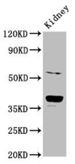 Invitrogen CD300g Polyclonal Antibody 100 &mu;g; Unconjugated:Antibodies,