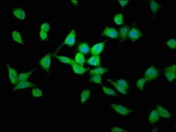 Invitrogen LAPTM4B Polyclonal Antibody 100 &mu;g; Unconjugated:Antibodies,