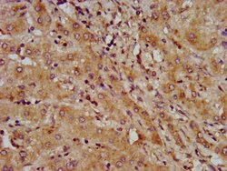 Invitrogen LAPTM4B Polyclonal Antibody 100 &mu;g; Unconjugated:Antibodies,