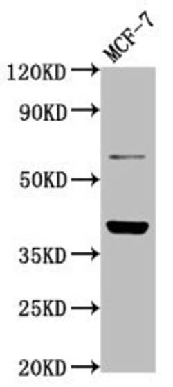 Invitrogen LAPTM4B Polyclonal Antibody 100 &mu;g; Unconjugated:Antibodies,
