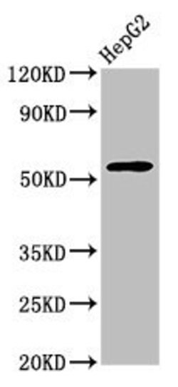 Invitrogen WDR37 Polyclonal Antibody 100 &mu;g | Buy Online | Invitrogen&trade; | Fisher Scientific
