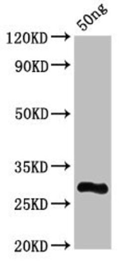 VSIV Protein L Polyclonal Antibody, Invitrogen 100 &mu;L; Unconjugated:Antibodies,