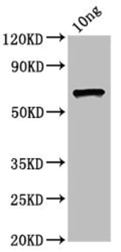 Invitrogen E. coli O157:H7 ompC Polyclonal Antibody 100 &mu;L; Unconjugated:Antibodies,
