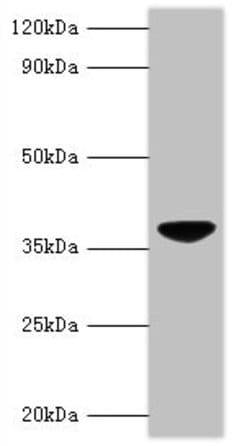 Invitrogen Chicken Anemia Virus VP3 Polyclonal Antibody 100 μg; Unconjugated:Antibodies,