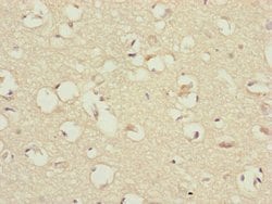 Invitrogen CEP83 Polyclonal Antibody 100 &mu;L; Unconjugated:Antibodies,