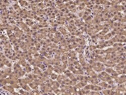 Invitrogen ACAT2 Polyclonal Antibody 100 &mu;L; Unconjugated:Antibodies,