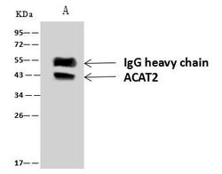 Invitrogen ACAT2 Polyclonal Antibody 100 &mu;L; Unconjugated:Antibodies,