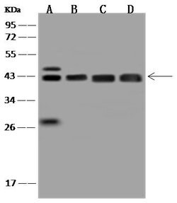 Invitrogen ACAT2 Polyclonal Antibody 100 &mu;L; Unconjugated:Antibodies,