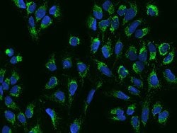 Invitrogen ACOT1 Polyclonal Antibody 100 &mu;L | Buy Online | Invitrogen&trade; | Fisher Scientific