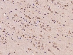 Invitrogen ACOT1 Polyclonal Antibody 100 &mu;L | Buy Online | Invitrogen&trade; | Fisher Scientific