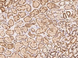 Invitrogen ACOT1 Polyclonal Antibody 100 &mu;L | Buy Online | Invitrogen&trade; | Fisher Scientific