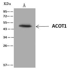 Invitrogen ACOT1 Polyclonal Antibody 100 &mu;L | Buy Online | Invitrogen&trade; | Fisher Scientific