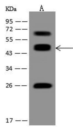 Invitrogen ACOT1 Polyclonal Antibody 100 &mu;L | Buy Online | Invitrogen&trade; | Fisher Scientific