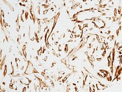 Alpha-Smooth Muscle Actin Rabbit anti-Human, Polyclonal, Invitrogen 100 &mu;L | Buy Online | Thermo Scientific | Fisher Scientific