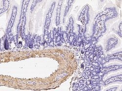 Alpha-Smooth Muscle Actin Rabbit anti-Human, Polyclonal, Invitrogen 100 &mu;L | Buy Online | Thermo Scientific | Fisher Scientific