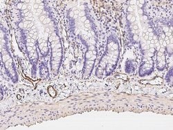 Alpha-Smooth Muscle Actin Rabbit anti-Human, Polyclonal, Invitrogen 100 &mu;L | Buy Online | Thermo Scientific | Fisher Scientific
